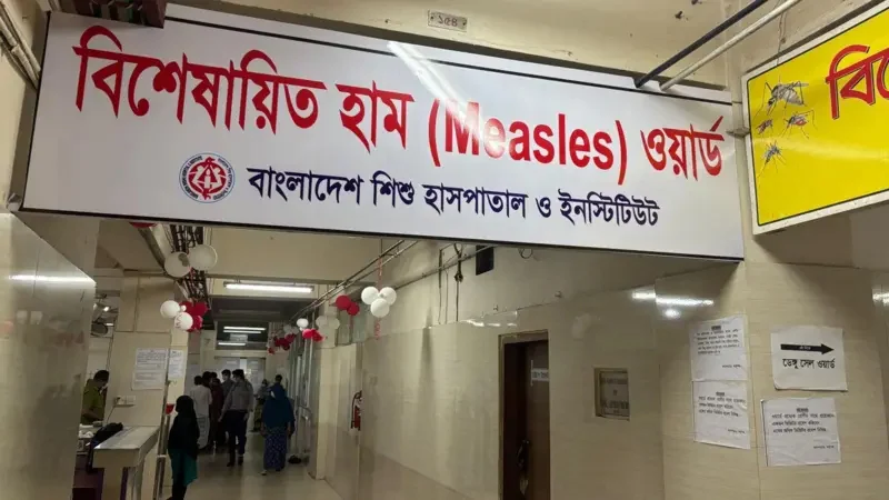 হামের উপসর্গ নিয়ে আরও ৪ শিশুর মৃত্যু